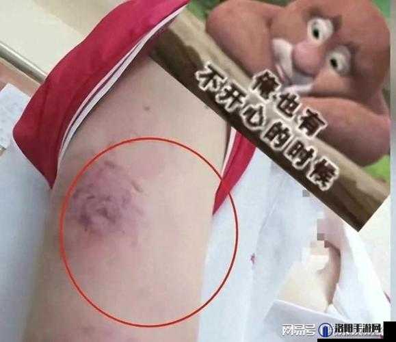 奶头被教官咬后又红又肿令人震惊的遭遇
