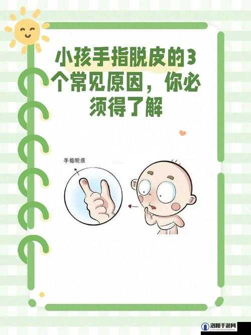 宝宝手指疼痛的原因及解决方法