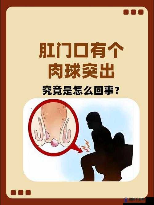 肛门口摸到个软软的肉要怎么消除：探寻有效解决办法