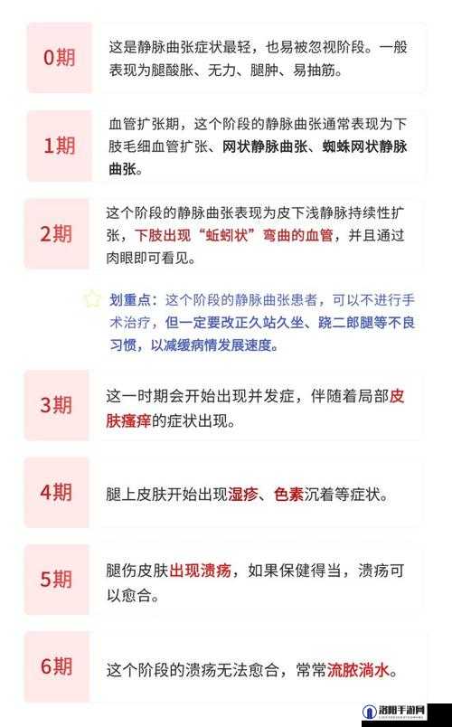 日系裸妆女士静脉曲张的原因是什么？