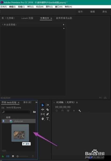 胸片曝光率软件：提升医疗诊断效率的必备工具