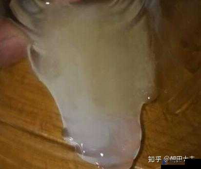 一激动就会有透明液体流出该如何应对