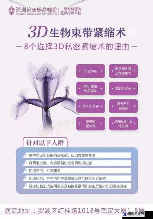 3D 生物束带紧缩术能维持几年：探究其长效性与影响因素