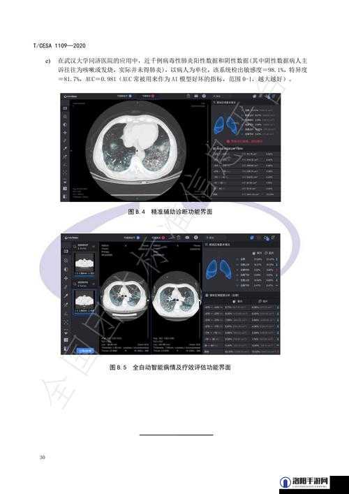 100%胸片曝光率软件助力医疗诊断精准化提升效率之必备工具