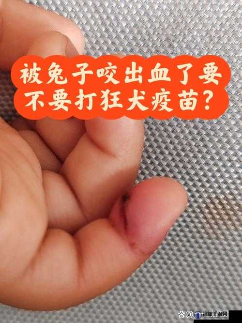 男朋友咬我的小兔子头会发炎吗？专家解析潜在风险与预防措施