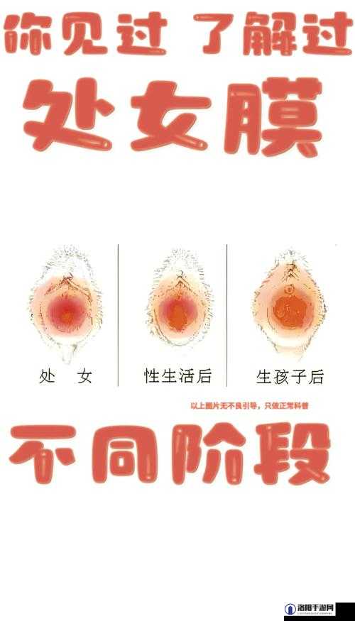 14 岁女生破处后需要多久才能恢复？