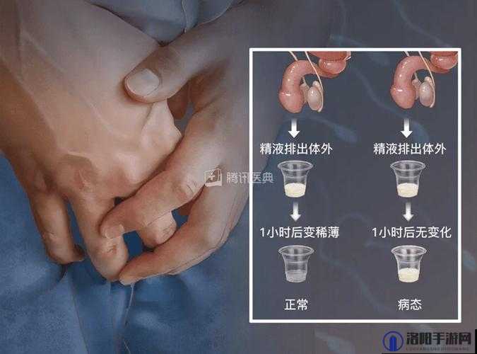 取精需要脱裤子吗？详细解析取精过程及注意事项