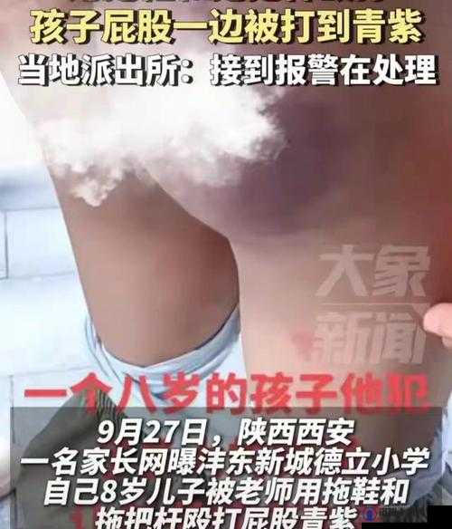 摁在腿上扒了视屁股打红肿：家庭教育中的体罚现象及其对孩子心理影响探讨