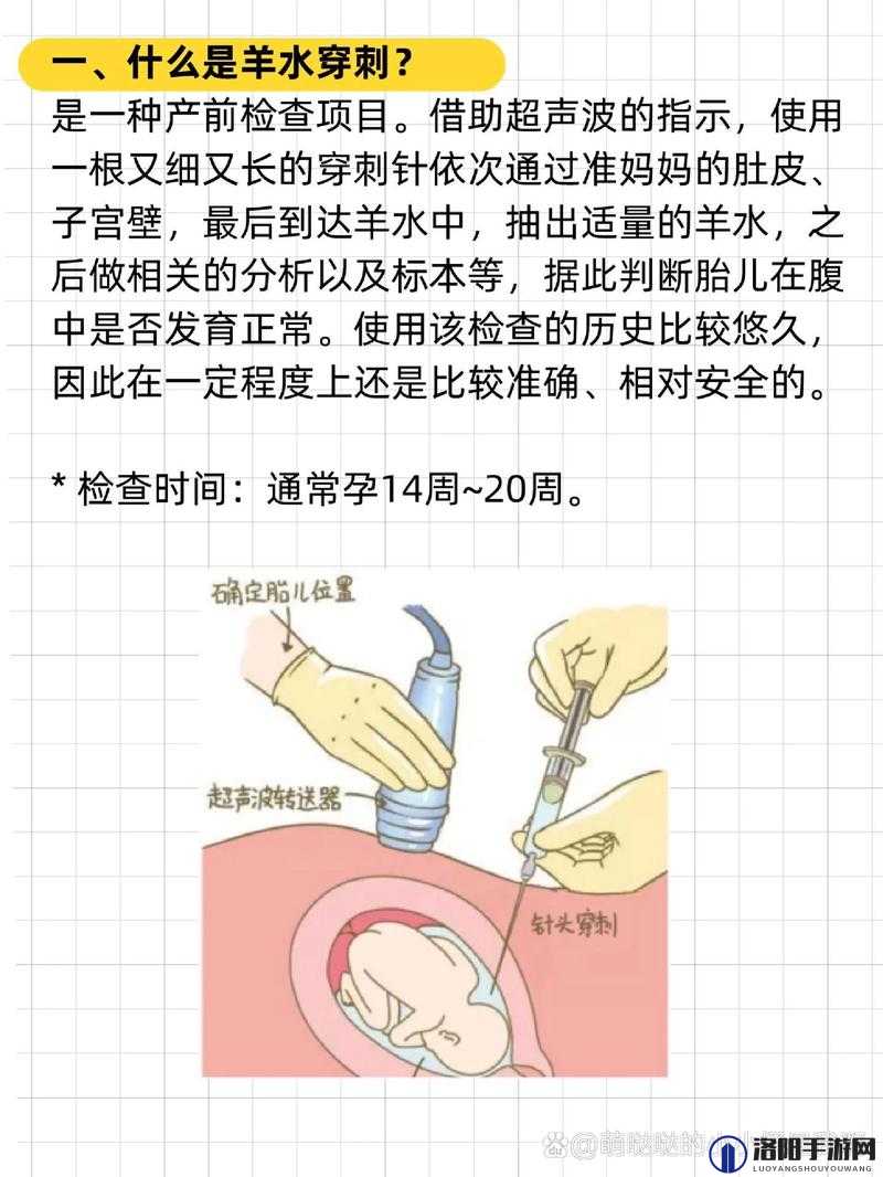 插羊水门最佳时间是什么时候？了解这些要点很关键或者：关于插羊水门最佳时间，你必须知道的那些事儿