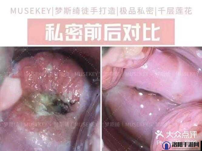 成年人私密部位特写是否应该被禁止？
