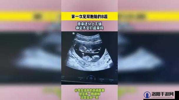 为何b超把男宝照成女宝？揭秘孕期B超性别鉴定误差的常见原因与应对方法